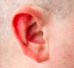 אוטוסקלרוזיס - תמונת אווירה